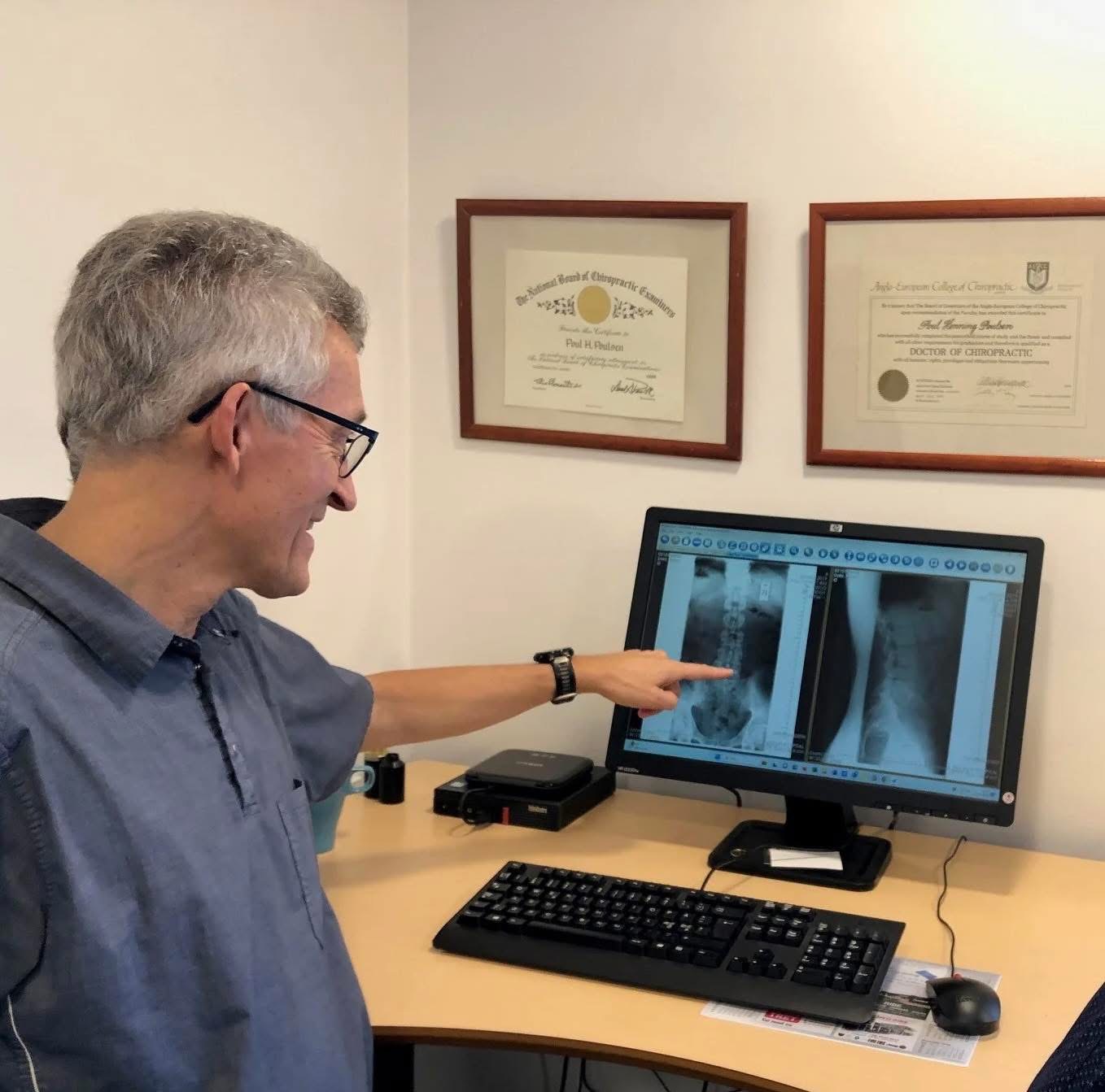 Undersøgelse af ryg og led hos kiropraktor Ribe